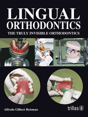 LINGUAL ORTHODONTICS: THE TRULY INVISIBLE ORTHODONTICS